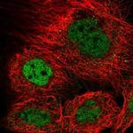 KIAA1310 Polyclonal Antibody