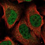 ATP6V1A Polyclonal Antibody