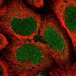 ATP6V1A Polyclonal Antibody