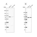 ATP6V1A Antibody in Western Blot (WB)
