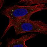 ABCB9 Polyclonal Antibody