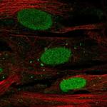 SHOX Polyclonal Antibody