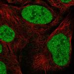 ZNF792 Polyclonal Antibody