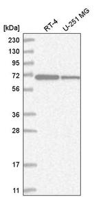 ZNF792 Antibody in Western Blot (WB)
