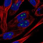 NOL10 Polyclonal Antibody