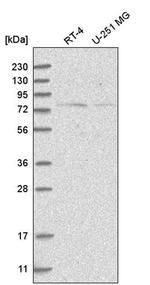 NOL10 Antibody in Western Blot (WB)