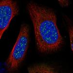 BARD1 Polyclonal Antibody