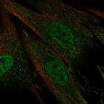 CERKL Polyclonal Antibody