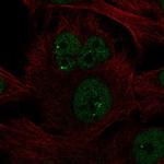 NME5 Polyclonal Antibody