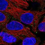 ANKRD6 Polyclonal Antibody