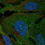 ARHGAP19 Polyclonal Antibody