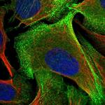 Palladin Polyclonal Antibody