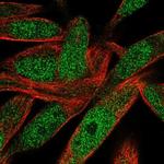 POLN Polyclonal Antibody