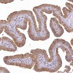 RNPEP Antibody in Immunohistochemistry (Paraffin) (IHC (P))