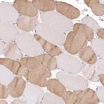 RNPEP Antibody in Immunohistochemistry (Paraffin) (IHC (P))
