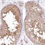 RNPEP Antibody in Immunohistochemistry (Paraffin) (IHC (P))