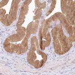 RNPEP Antibody in Immunohistochemistry (IHC)