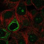 NOL9 Polyclonal Antibody