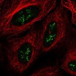 TMEM177 Polyclonal Antibody