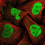 TOPBP1 Polyclonal Antibody