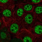 HELQ Polyclonal Antibody