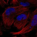 Gemin 5 Polyclonal Antibody