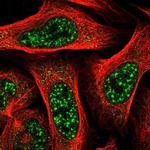 TBC1D8 Polyclonal Antibody