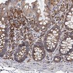 RASSF6 Antibody in Immunohistochemistry (Paraffin) (IHC (P))