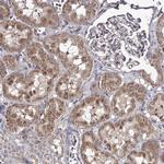 RASSF6 Antibody in Immunohistochemistry (Paraffin) (IHC (P))