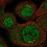 RASSF6 Antibody in Immunocytochemistry (ICC/IF)