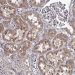 RASSF6 Antibody in Immunohistochemistry (IHC)