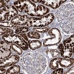 DHTKD1 Antibody in Immunohistochemistry (Paraffin) (IHC (P))