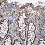 DHTKD1 Antibody in Immunohistochemistry (Paraffin) (IHC (P))