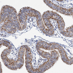 DHTKD1 Antibody in Immunohistochemistry (Paraffin) (IHC (P))