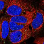 EDA Antibody in Immunocytochemistry (ICC/IF)