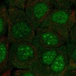 C10orf67 Polyclonal Antibody