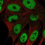 GAL3ST4 Polyclonal Antibody