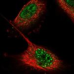 ZNF551 Polyclonal Antibody