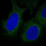 DIP2B Polyclonal Antibody