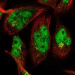 OTUD1 Polyclonal Antibody