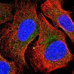 NADSYN1 Polyclonal Antibody