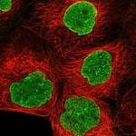 AMPD3 Antibody in Immunocytochemistry (ICC/IF)