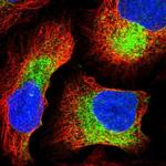 IKBIP Polyclonal Antibody