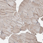 SPG20 Antibody in Immunohistochemistry (Paraffin) (IHC (P))