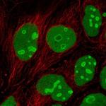 EMG1 Polyclonal Antibody