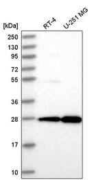 EMG1 Antibody in Western Blot (WB)