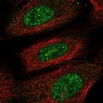 PRR13 Polyclonal Antibody