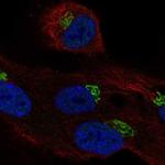 LRRC43 Polyclonal Antibody