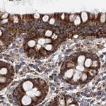 SUCLA2 Antibody in Immunohistochemistry (IHC)