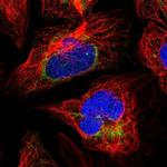 SUCLA2 Polyclonal Antibody